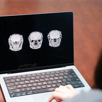 Three rodent brain MRI images are displayed horizontally on a laptop screen.